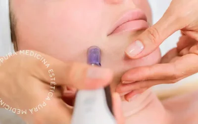 Innovación en Belleza: Dermapen y Limpieza Facial en Málaga con Grupo Main